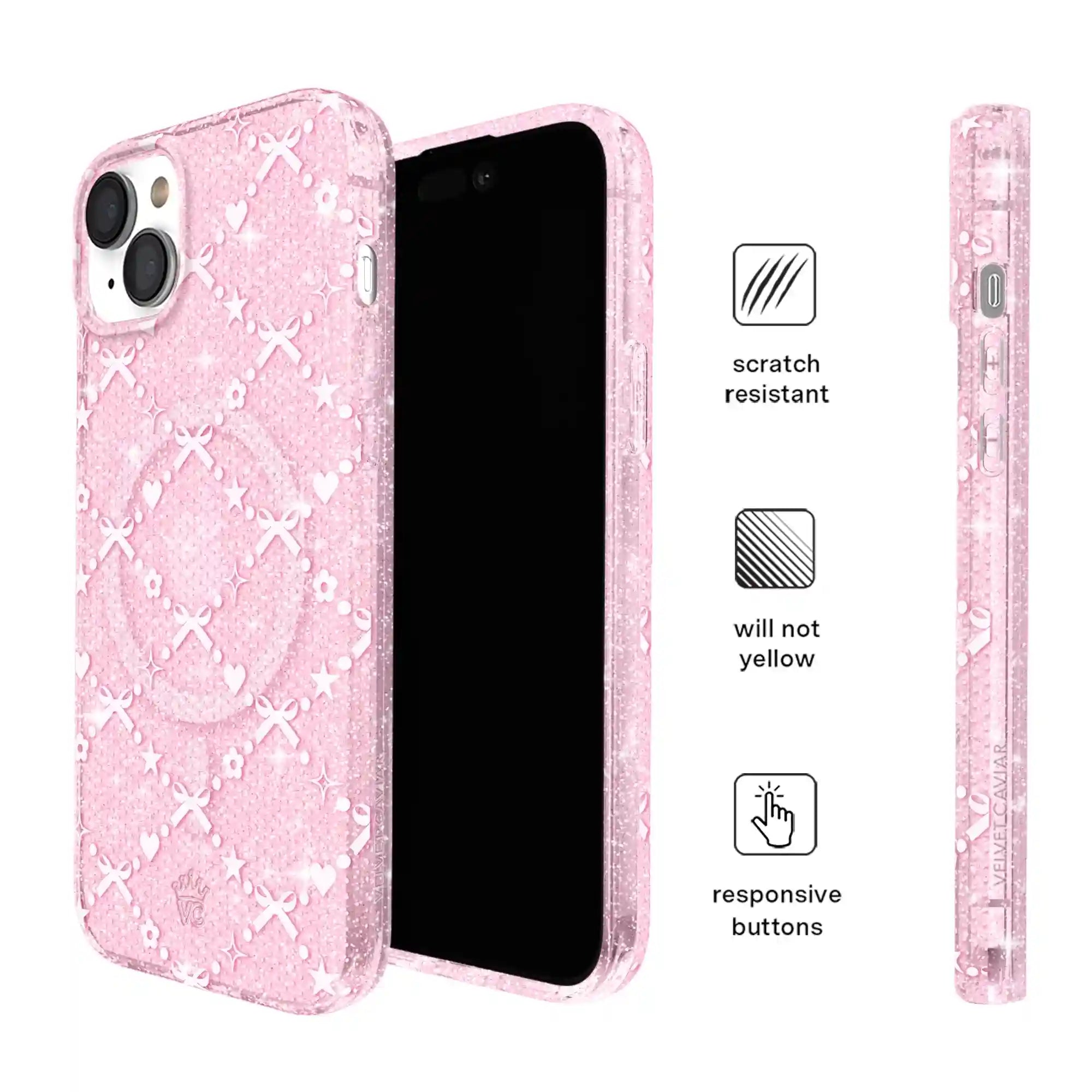 Sugar Baby Glitter iPhone Case
