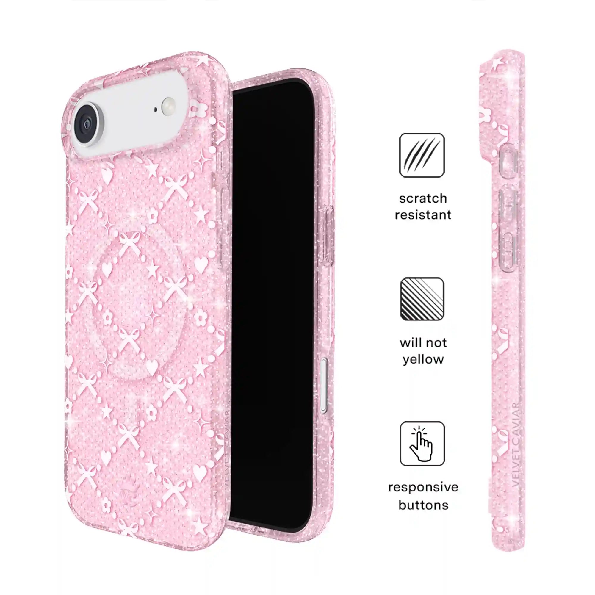Sugar Baby Glitter iPhone Case
