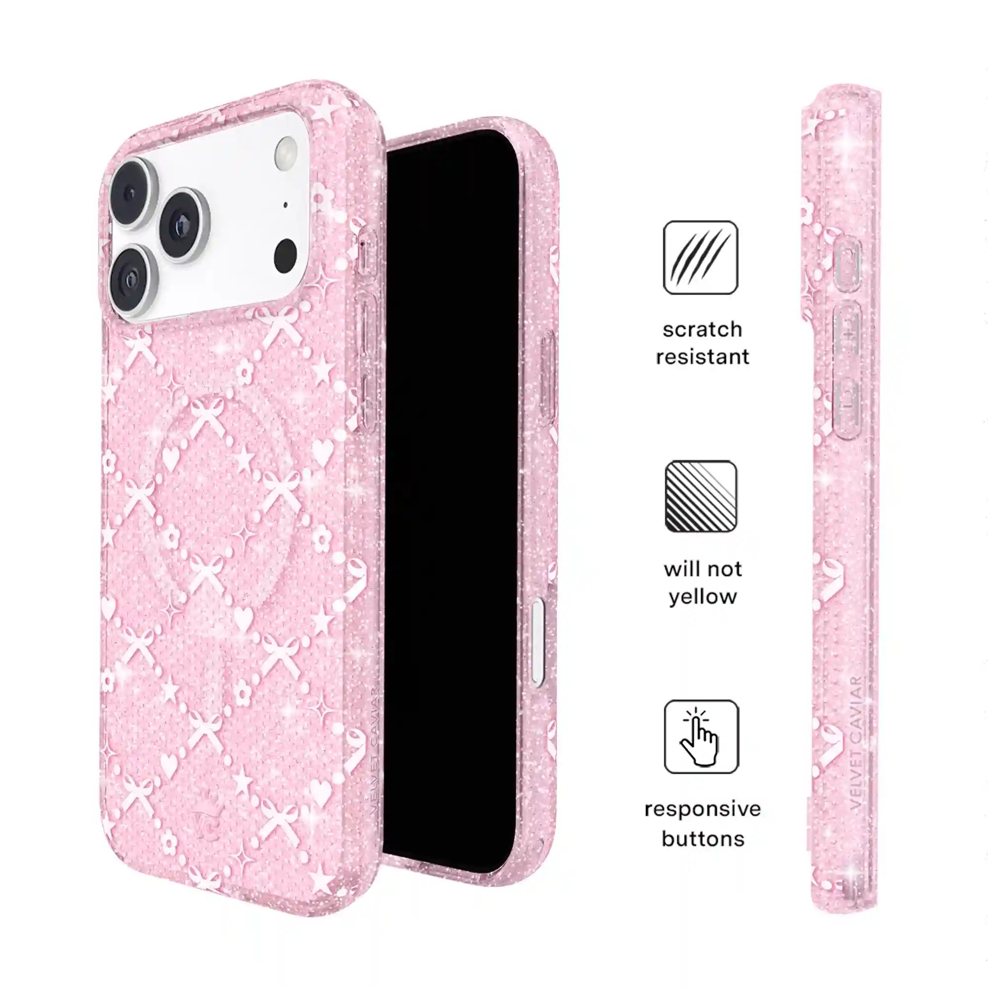 Sugar Baby Glitter iPhone Case